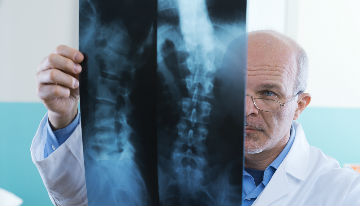 Spinal Cord injury lawyer